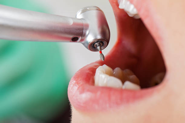 Best Emergency Dentist for Knocked-Out Tooth in Woodlyn, PA
